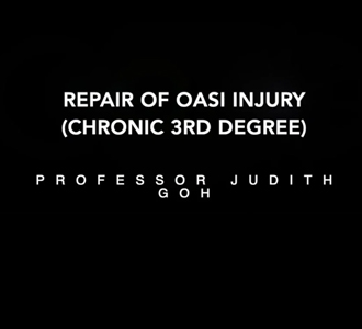 2JudithGoh-RepairOfOasiInjury